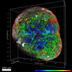 Human vascular organoids reveal clues for a potential COVID treatment