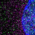 Huntingtons disease driven by slowed protein-building machinery in cells