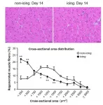 Icing muscle injuries may delay recovery