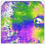 Imaging fibrous structure abnormalities of the white of the eye in myopathic patients