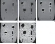 Imaging of ballistic wounds, bullet composition and implications for MRI safety