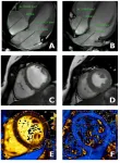 Imaging the adolescent heart