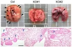 Immobilizing melanoma 2