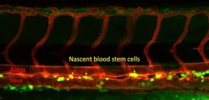 Immune system plays crucial step in creating blood stem cells