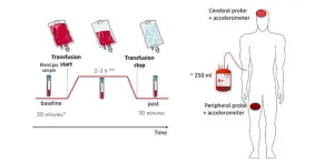 Improving blood transfusion monitoring in critical care patients: Insights from diffuse optics