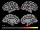 In recognizing speech sounds, the brain does not work the way a computer does 2