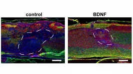 Injectable porous scaffolds promote better, quicker healing after spinal cord injuries