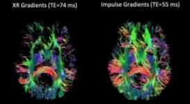 Innovative design achieves tenfold better resolution for functional MRI brain imaging 3