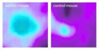 Insular cortex alterations in mouse models of autism