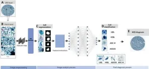 Intelligent fight: AI enhances cervical cancer detection