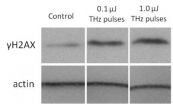 Intense terahertz pulses cause DNA damage but also induce DNA repair