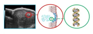 Intense ultrasound extracts genetic info for less invasive cancer biopsies #ASA186