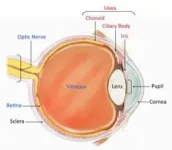 International coalition classifies 25 subtypes of uveitis, an inflammatory eye disease