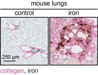 Iron accumulation: a new insight into fibrotic diseases