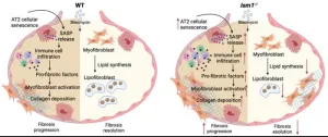 Ism1 deficiency in mice exacerbates bleomycin-induced pulmonary fibrosis with enhanced cellular senescence and delayed fibrosis resolution