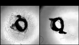 iSN04: A novel nucleic acid drug for the treatment of vascular diseases