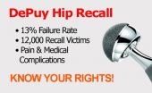 Johnson & Johnson Paying Doctors to Help Obtain DePuy Hip Recall Victims Private Medical Records