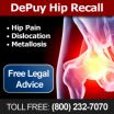 Johnson & Johnson Paying Doctors to Help Obtain DePuy Hip Recall Victims' Private Medical Records 2