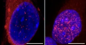 Key pathway leading to neurodegeneration in early stages of ALS identified