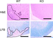 Key protein linked to immune disorders