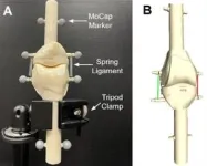 Knees up! Computational modeling could improve knee implant alignment 2