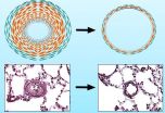 Lack of transcription factor FoxO1 triggers pulmonary hypertension