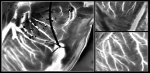 Laser speckle imaging can identify hearts suitable for transplantation