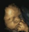 Left-handed fetuses could show effects of maternal stress on unborn babies