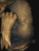 Left-handed fetuses could show effects of maternal stress on unborn babies 2