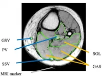 Leg muscle action assists blood flow independently of age