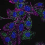 Leukemia cells activate cellular recycling program