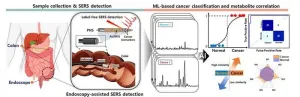 Light-AI technology opens the door to early cancer diagnosis