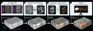 LIONESS redefines brain tissue imaging 2