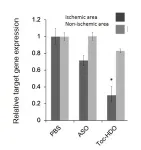 Lipid molecules help to get stroke therapies into the brain 2