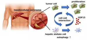 Liver cancer cells manipulate stromal cells involved in fibrosis to promote tumor growth