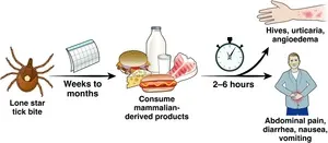 Lone star tick bites may be to blame for unexplained digestive problems 2