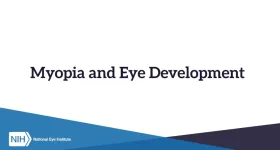 Low-dose atropine eyedrops no better than placebo for slowing myopia progression