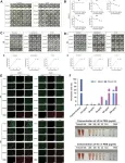 Machine learning identifies antimicrobial peptide candidate for ulcerative colitis 2