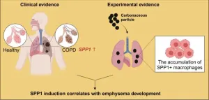 Macrophages express high level of Spp1, linking the environmental particle pollution exposure and the development of emphysema - an important finding for COPD