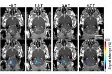 Magnetic field from MRI affects focused-ultrasound-mediated blood-brain barrier