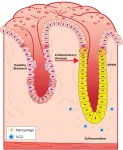 Male hormones regulate stomach inflammation in mice