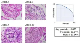 Male infertility scoring using AI-assisted image classification requiring no programming