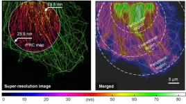 Mapping local quality at super-resolution scale