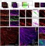 Mapping local quality at super-resolution scale 2