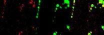 Mechanism of dengue virus entry into cells 3