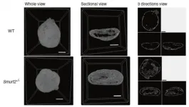 Meet the Smurfs: A bone metabolism family