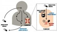 Metal implants may cut chemotherapy side effects, study suggests