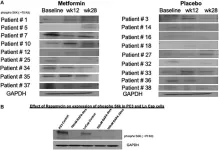 Metformins role in preventing metabolic syndrome during androgen deprivation therapy: a Phase II study