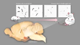 Middle-age obesity is caused by changes in the shape of neurons in the brain