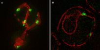 Misfolded proteins clump together in a surprising place 2